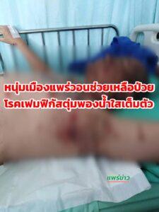 หนุ่มเมืองแพร่วอนช่วยเหลือป่วยเป็นโรคเฟมฟิกัสตุ่มพองน้ำใสขึ้นเต็มตัว