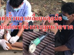 (มีคลิป)ช่างทำรั้วพลาดเลื่อยหลุดมือสะบัดตัดเท้าถึงกระดูกหวิดขาด